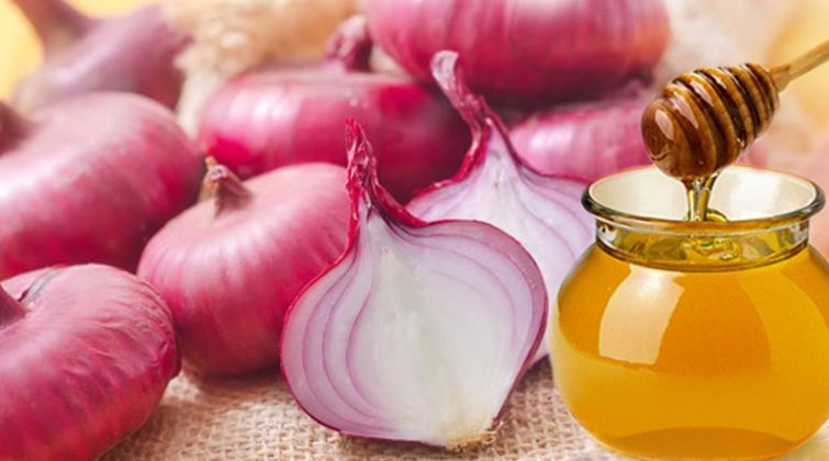 Ceapa roșie - Remediu natural pentru topirea varicelor