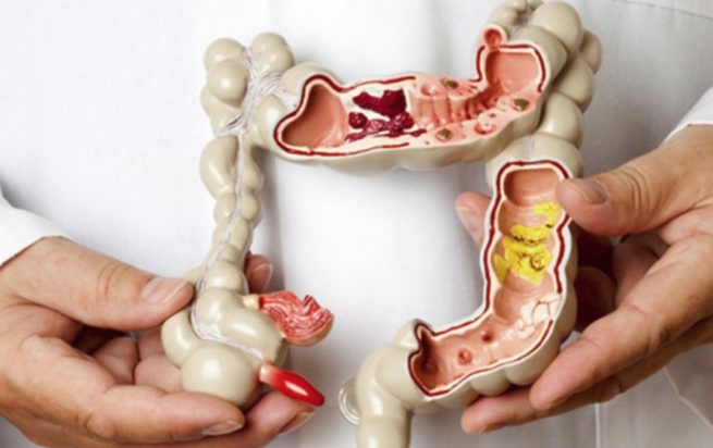 Salata care te ajută să cureți intestinele și să slăbești rapid. Mânânc-o timp de 3 zile