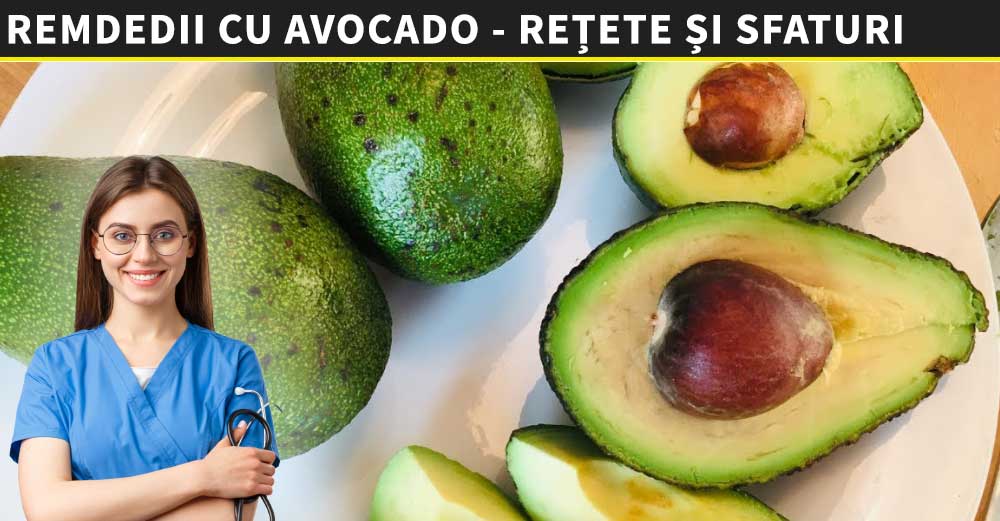 avocado-pareri