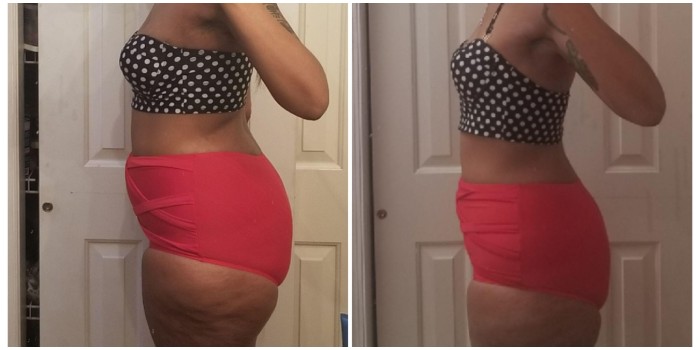 Cea mai simplă metodă pentru a scăpa de celulită - Alimentele care-ți dau înapoi acel aspect plăcut al picioarelor