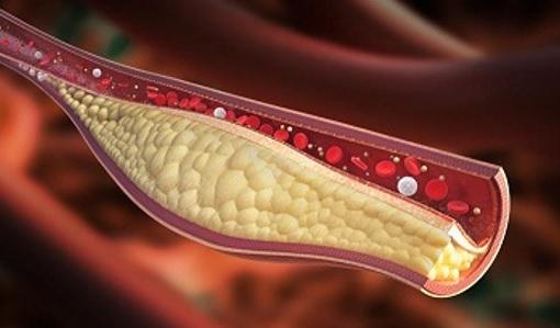 Colesterolul – adevăruri pe care doctorii nu ni le spun. Ce ar trebui să știi?