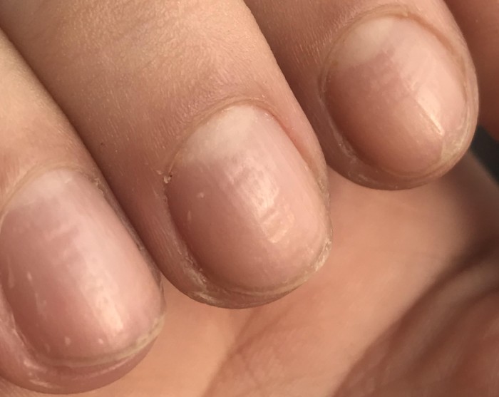 Știai că îți poți da seama dacă ești bolnav uitându-te la culoarea unghiilor tale? Iată care sunt semnele