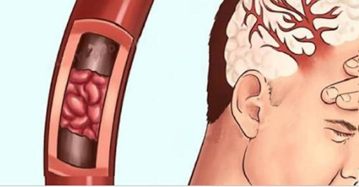 Dacă te confrunți cu aceste simptome