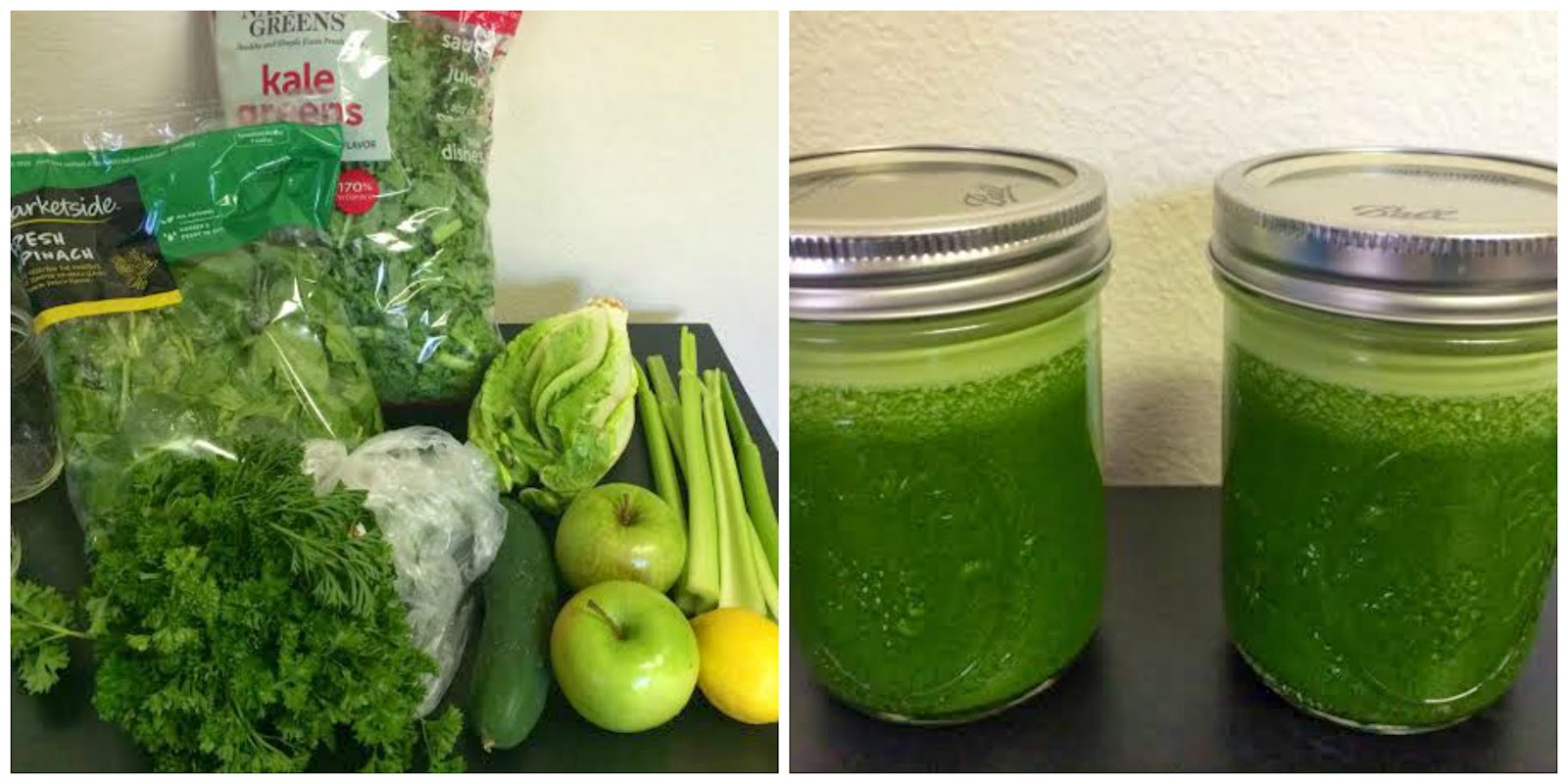 Așa scapi de constipatie și balonare. Remedii naturale