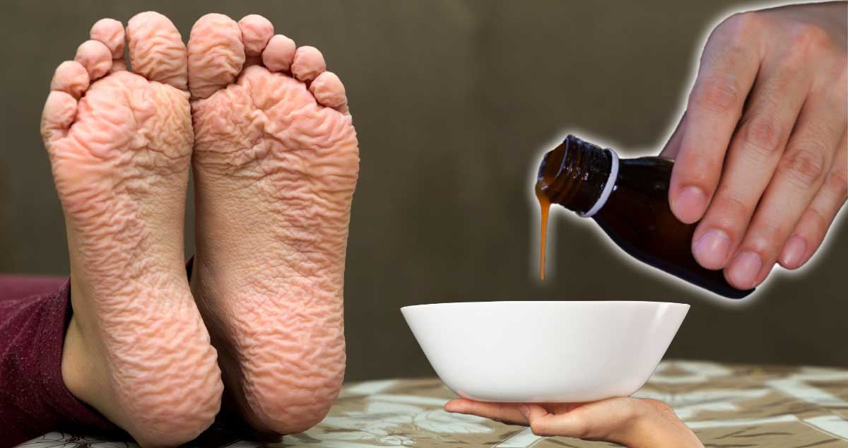 BAIE Pentru DURERILE de PICIOARE - Vezi CE TREBUIE SĂ PUI în APĂ. Iți ia DUREREA cu MÂNA!