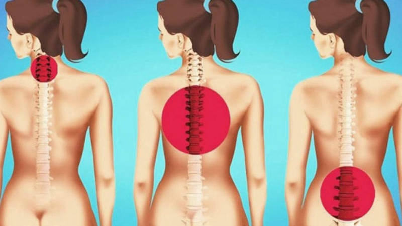 Fă aceste exerciții și uită de durerile de spate odată pentru totdeauna