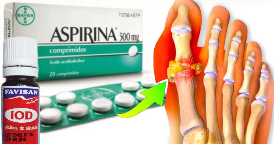 Scapă de DURERI cu acest AMESTEC: Aspirina