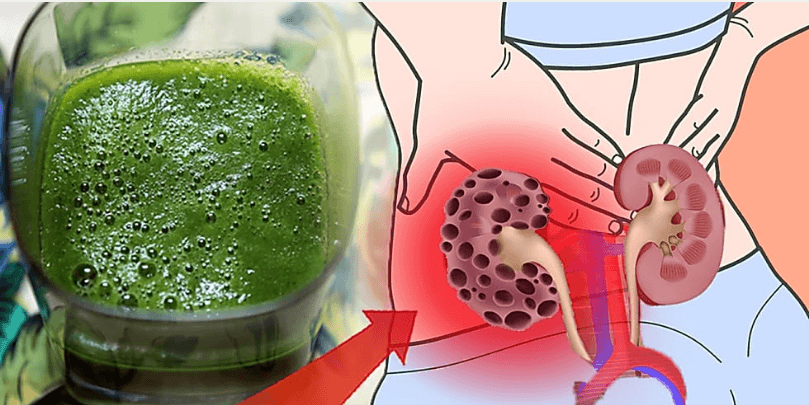 Medicamentul natural numărul 1 - Uiți Complet de Infecțiile Urinare