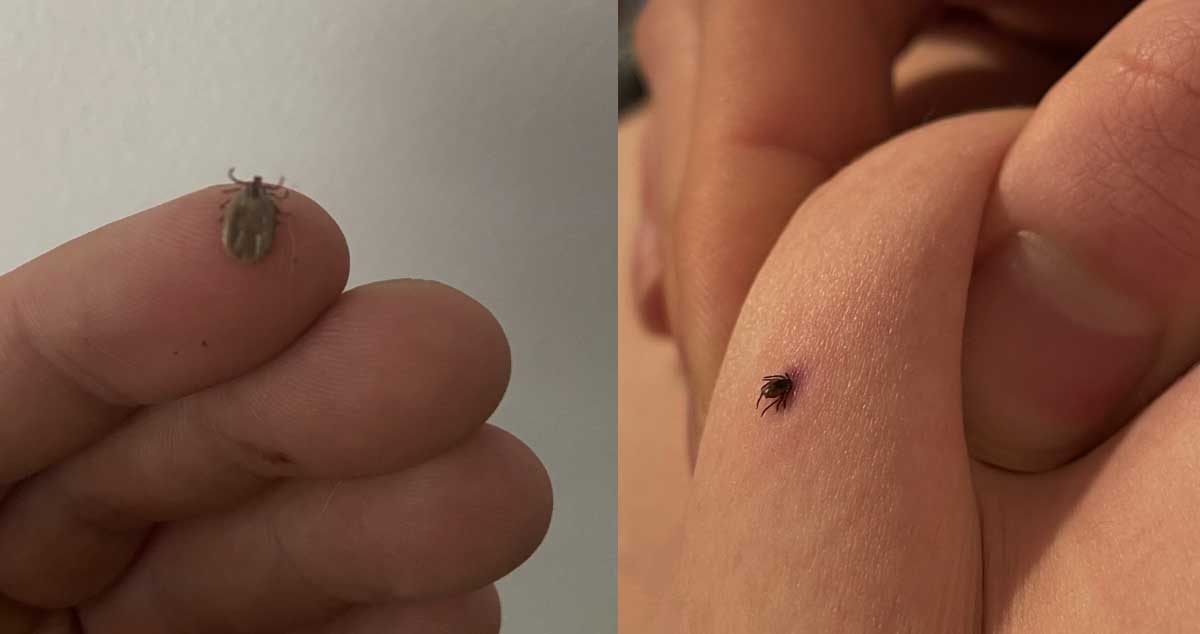 Ce Să Faci Când Găsești o Căpușă? Metoda Care Funcționează Întotdeauna