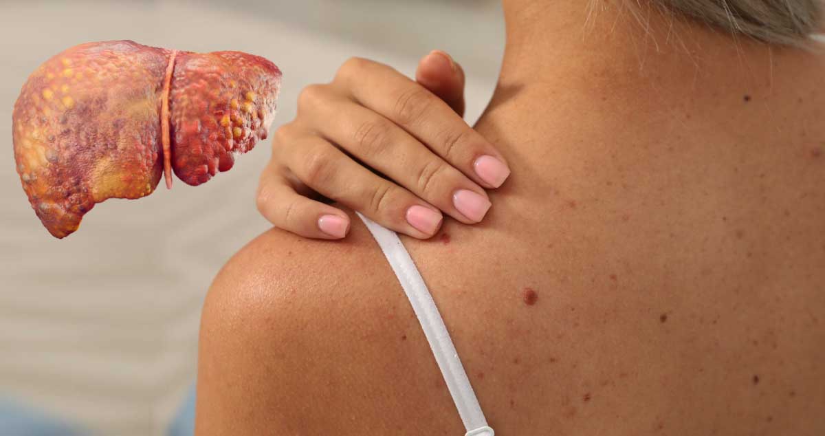 PRIMELE SEMNE care îți arată că FICATUL tău nu mai FUNCȚIONEAZĂ în mod CORECT. Ce trebuie să faci?