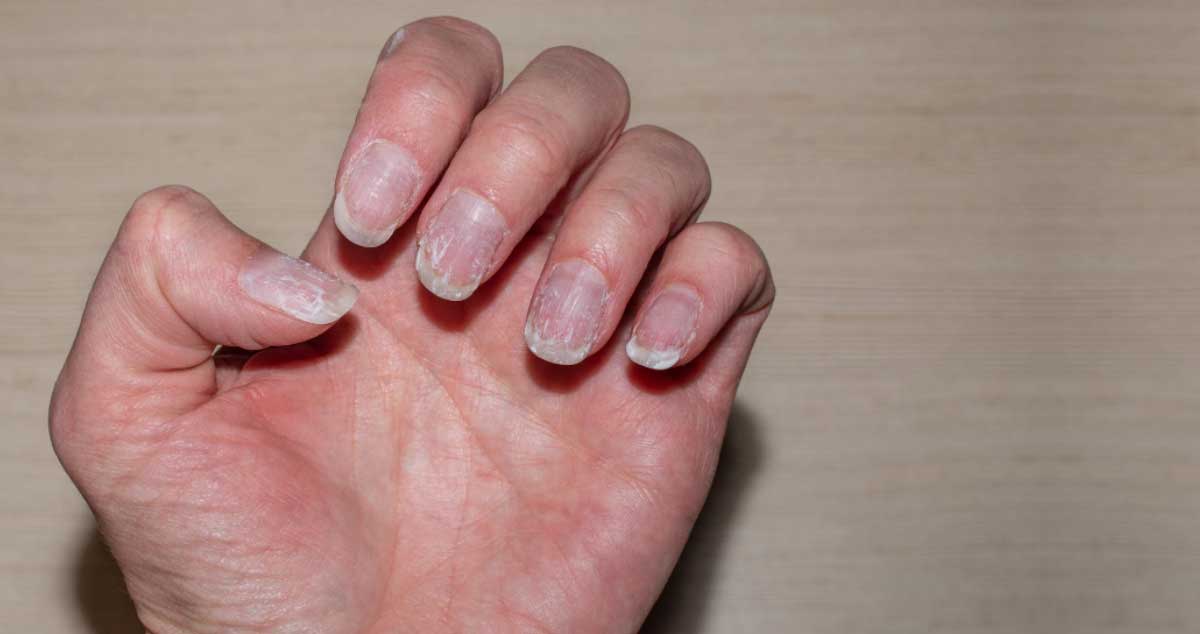 6 SEMNE că ai LIPSĂ de ZINC în ORGANISM! Vezi ce trebuie să faci dacă ai aceste semne