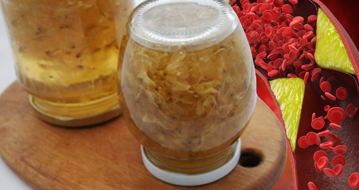 Tinctura de IASOMIE - Rețeta pentru GUTĂ și INFUNDAREA vaselor DE SÂNGE